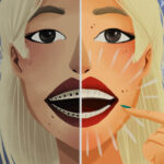 Illustration of a blonde woman wearing braces on half her smile and Invisalign on the other half to compare orthodontic treatments