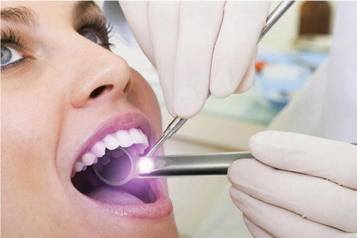 woman undergoing laser gum therapy