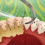 deep teeth cleaning for gum disease
