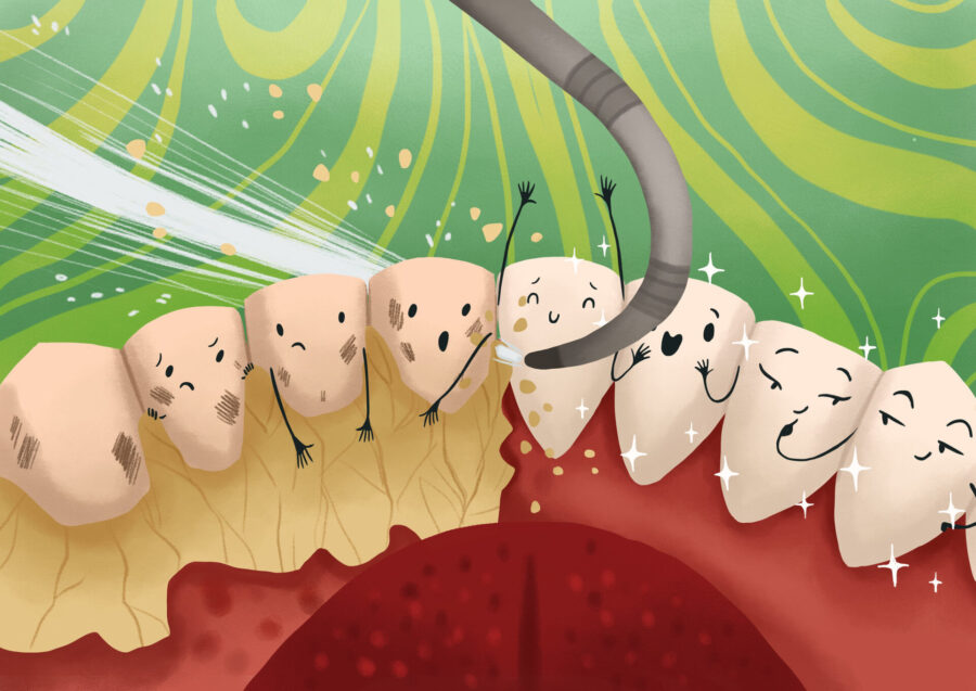 deep teeth cleaning for gum disease