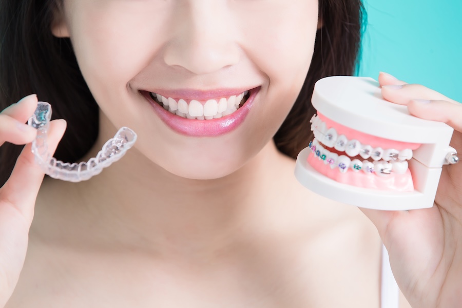 metal braces vs invisalign clear aligners